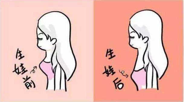 中频乳腺治疗仪讲解胸部下垂那些事